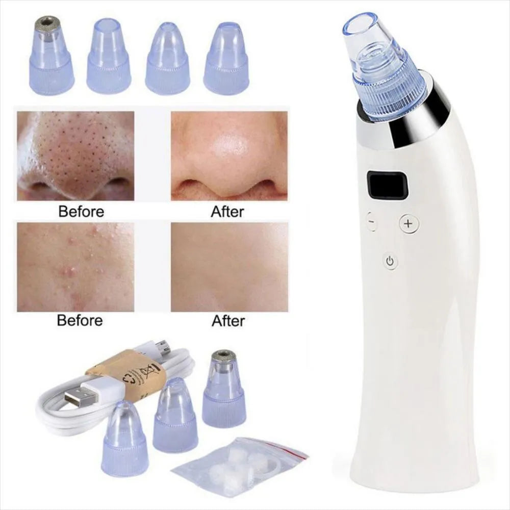 Extractor De Puntos Negros